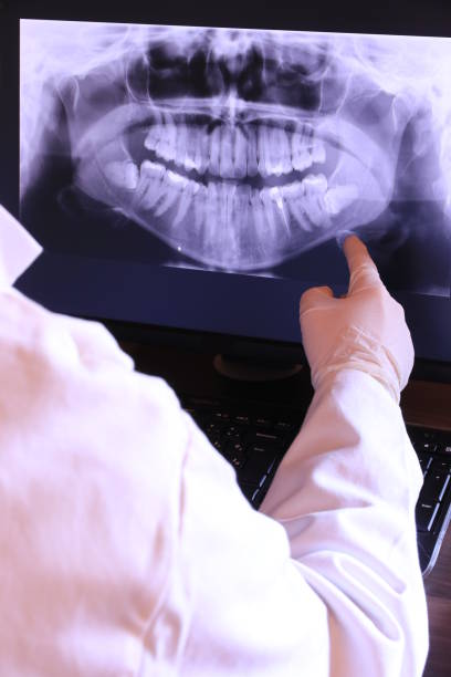 Best Walk-In Emergency Dentist in Aquebogue, NY