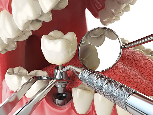 Best Emergency Treatment for Toothache in Aquebogue, NY